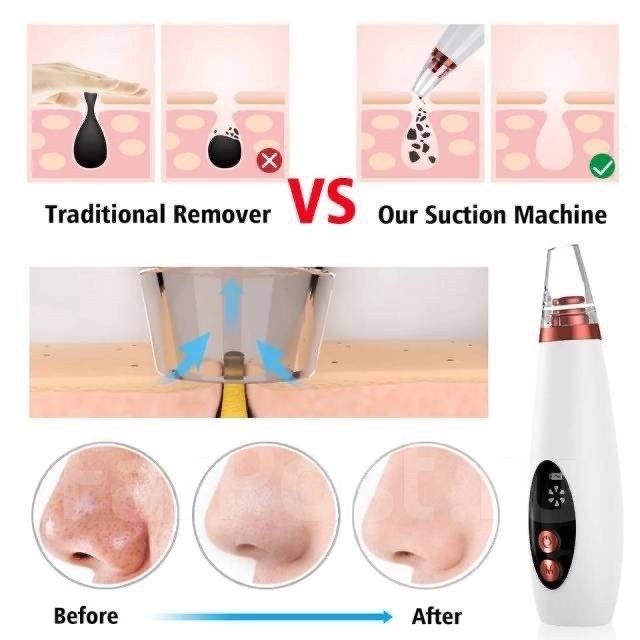 вакуумный очиститель пор для лица remove blackhead device,аппарат для вакуумной чистки лица,вакуумный очиститель лица,вакуумный очиститель пор,прибор вакуумной чистки лица